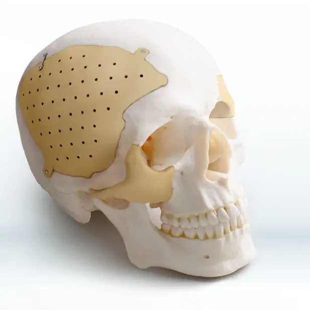 Система восстановления черепно-челюстно-лицевой поверхности Recranio TM